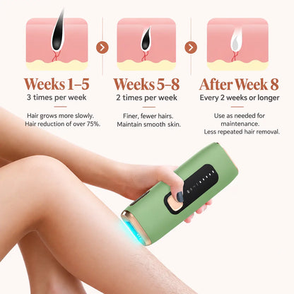 YIUU P3 Pro IPL Hair Removal Device